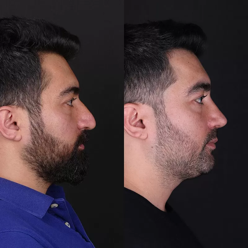elad-azizli-bef-10.jpg